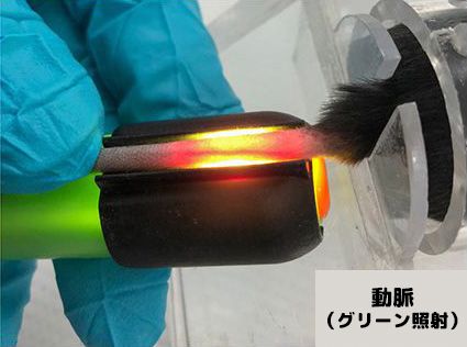 veinlite_artery.jpg